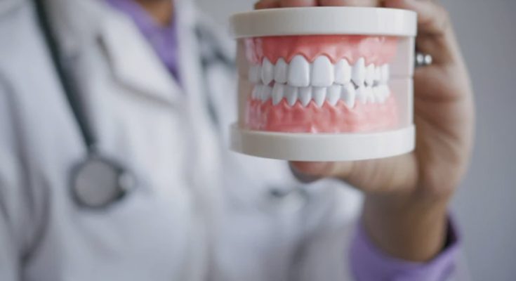 Denture Implants