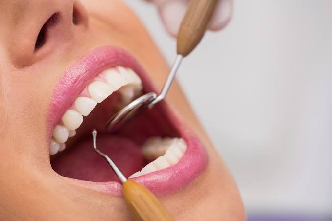 Advantages of Teeth Cleaning