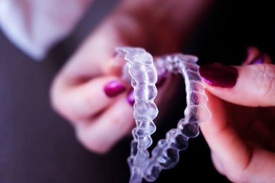 The Invisalign process explained