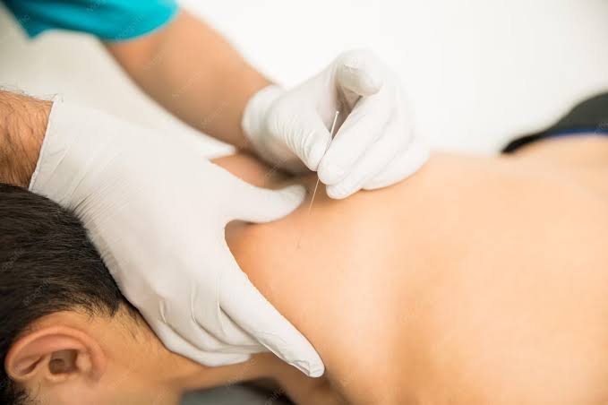 Needling Helps Recovery